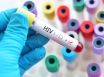 HIV test vial